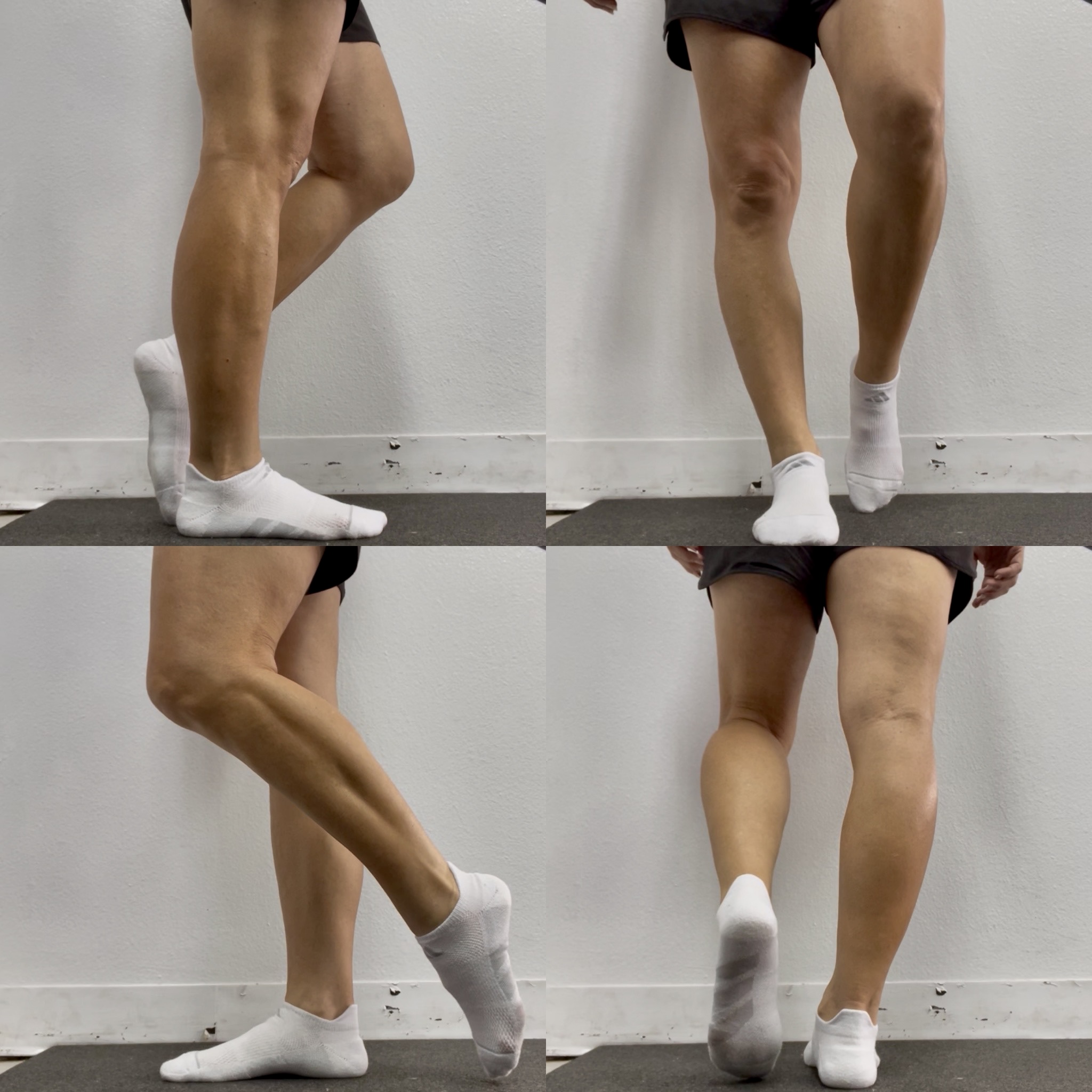 Foot Posture Evaluation